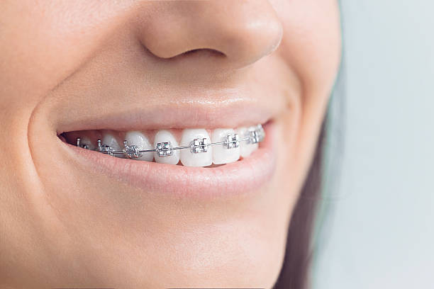 Best Full Mouth Reconstruction  in Hydesville, CA